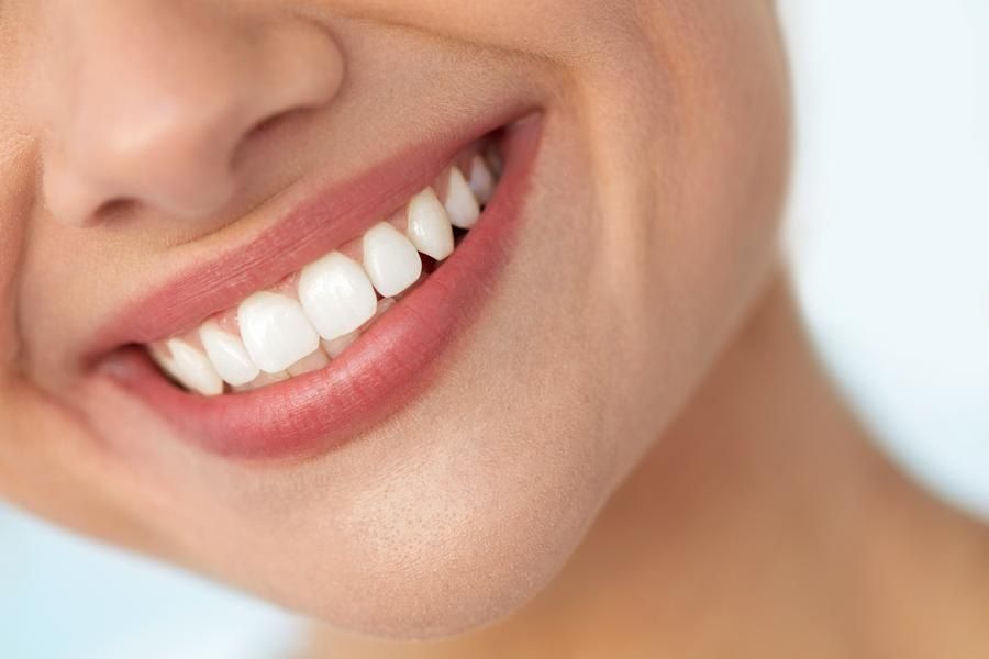 Close-up of woman's beautiful smile with healthy teeth and gums in San Francisco