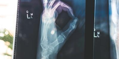 Endoscopia Terapéutica: Casos Clínicos