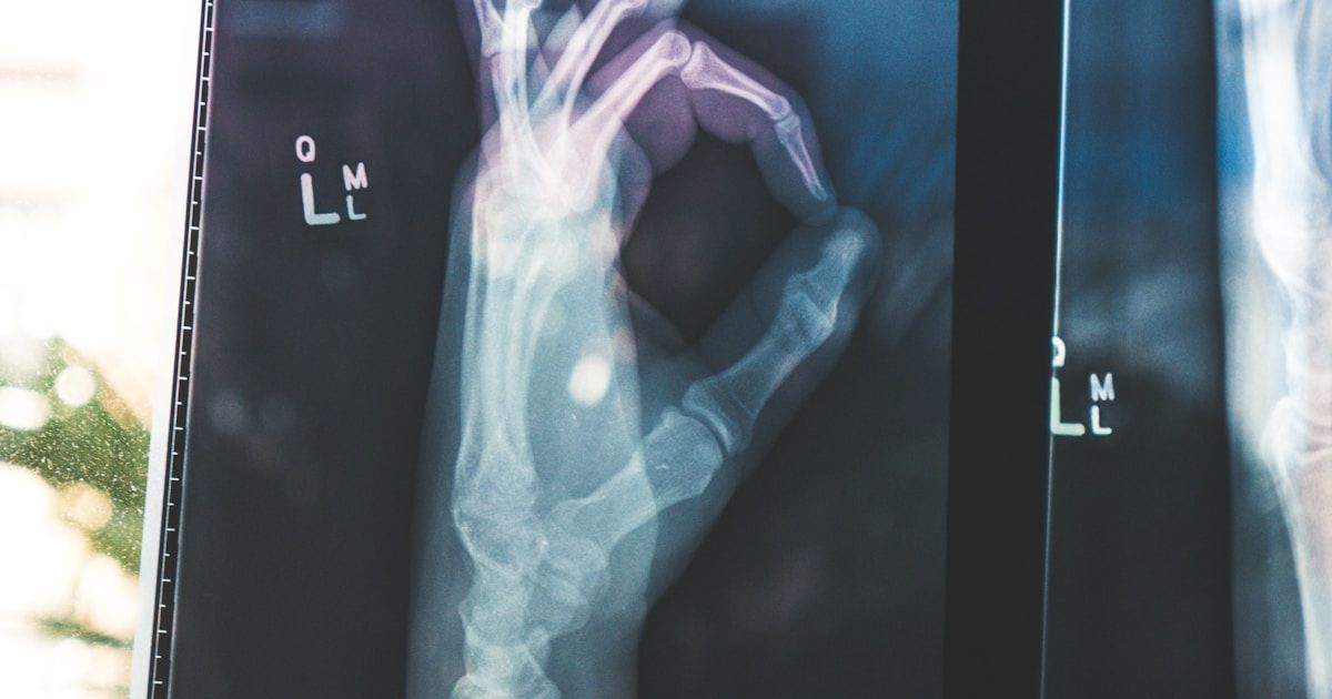 Cómo prepararse para una endoscopia digestiva