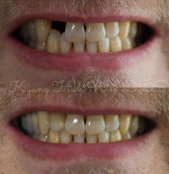 smile gallery photo 14