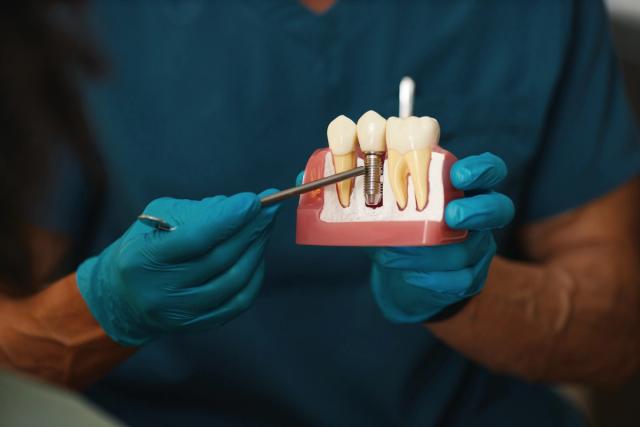 a dentist is holding a model of a dental implant in his hands .