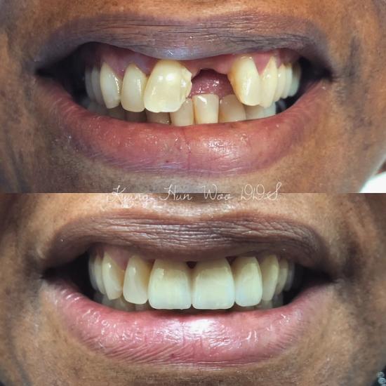 smile gallery photo 8