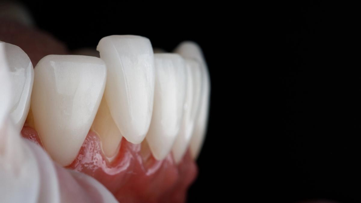 a close up of a person 's teeth with a black background .