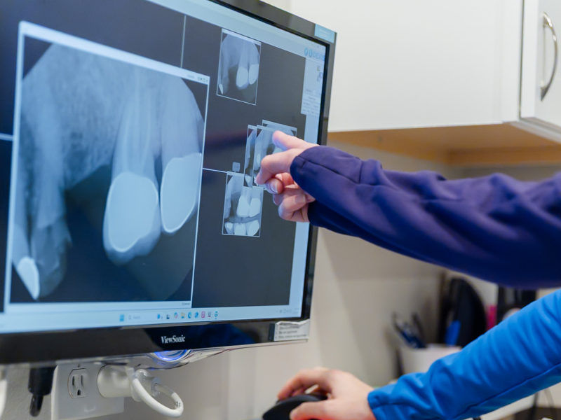 A hand points at a computer monitor displaying dental X-rays, while another hand uses a mouse.