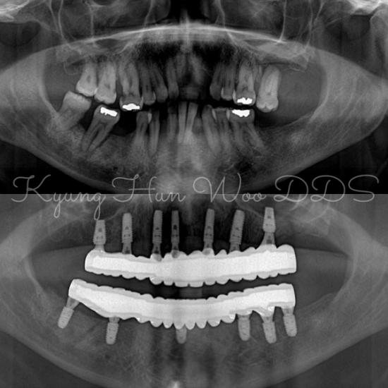 smile gallery photo 10