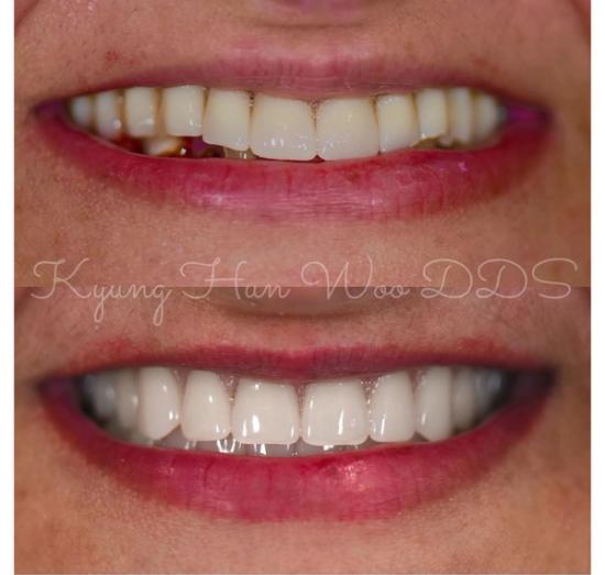 smile gallery photo 2