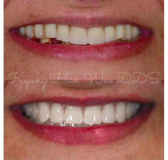 smile gallery photo 2