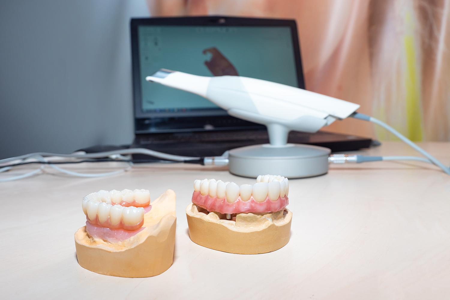 two models of teeth sit on a table in front of a laptop