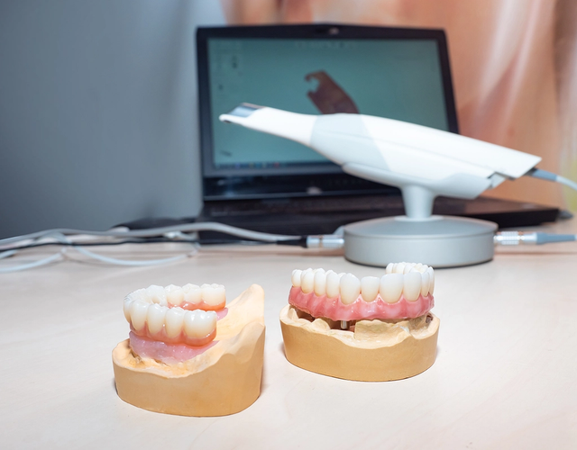two models of teeth sit on a table in front of a laptop