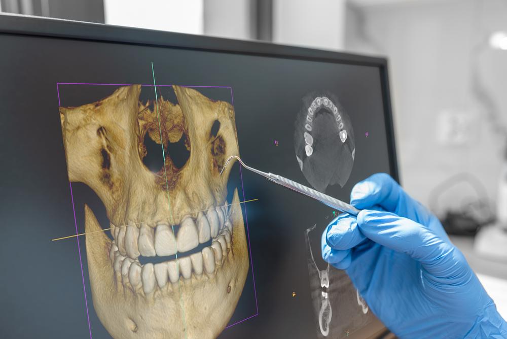 Dentist's gloved hand points a tool at a monitor displaying a 3D jaw scan and an X-ray.