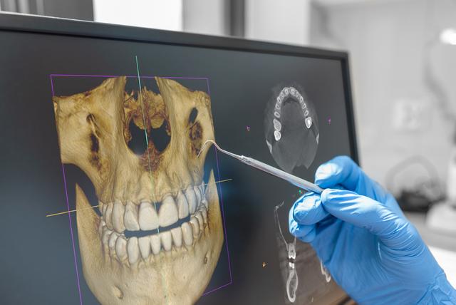 a dentist is holding a dental tool in front of a computer screen .