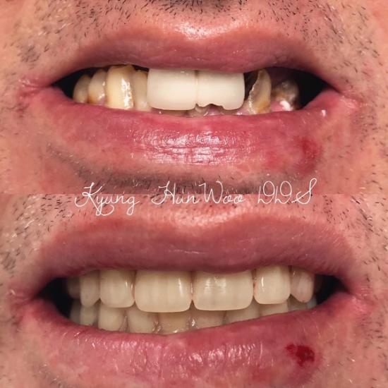 smile gallery photo 6