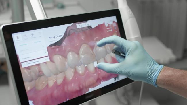 a dentist is using a tablet computer to scan a patient 's teeth .