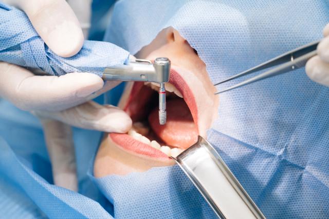 a woman is getting a dental implant in her mouth .