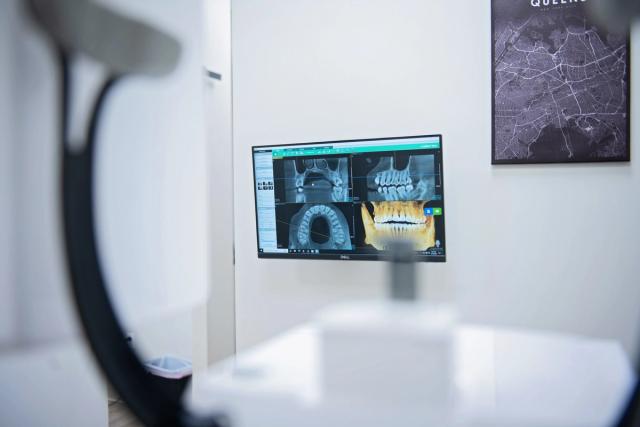 an x-ray of a person 's teeth is on a computer screen in a dental office .