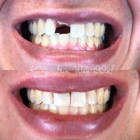 smile gallery photo 12