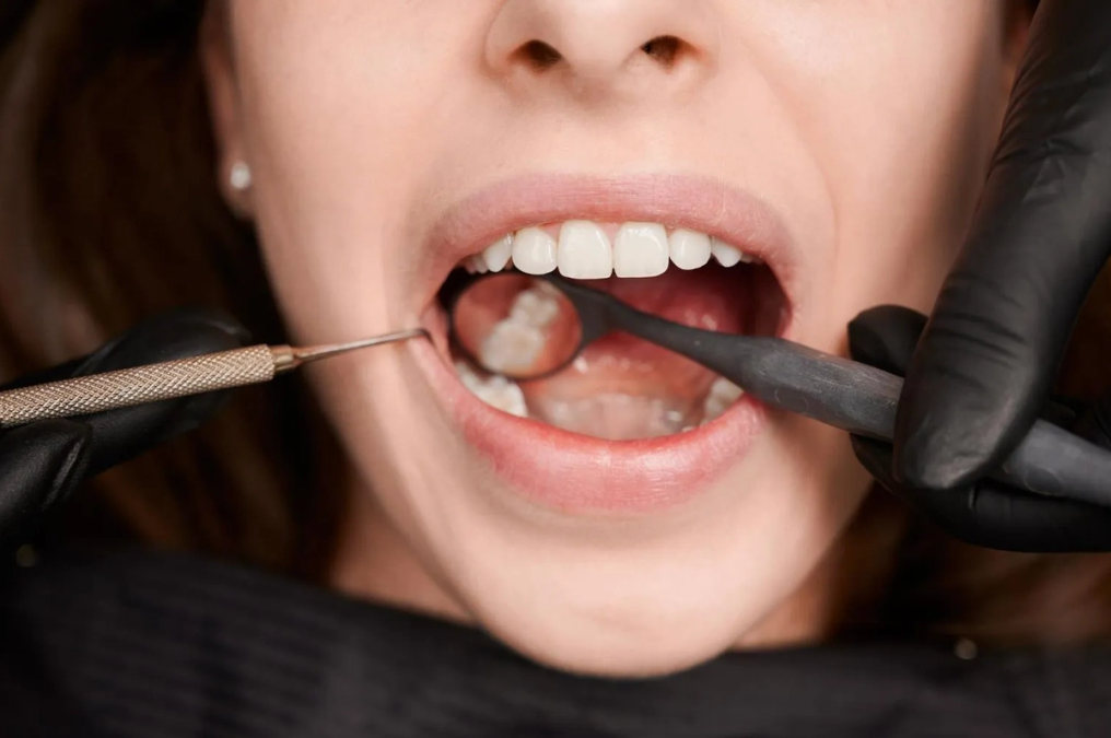 a woman is getting her teeth examined by a dentist