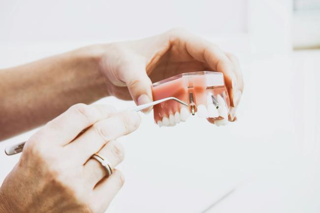 a person is holding a model of a dental implant in their hands .