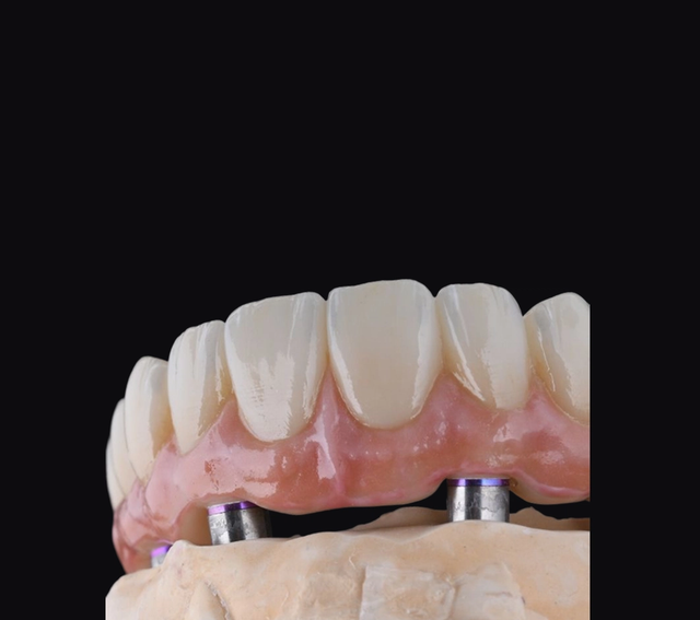 a close up of a denture with a black background