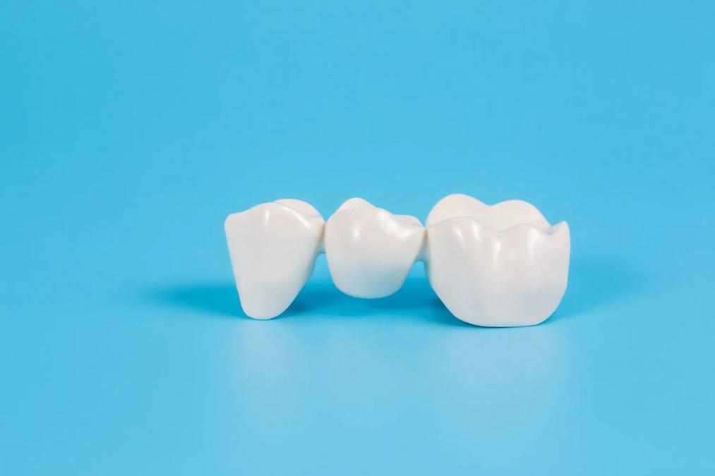 a model of a dental bridge on a blue background .