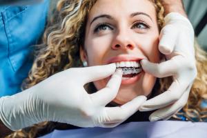 a woman is getting her teeth straightened by a dentist .