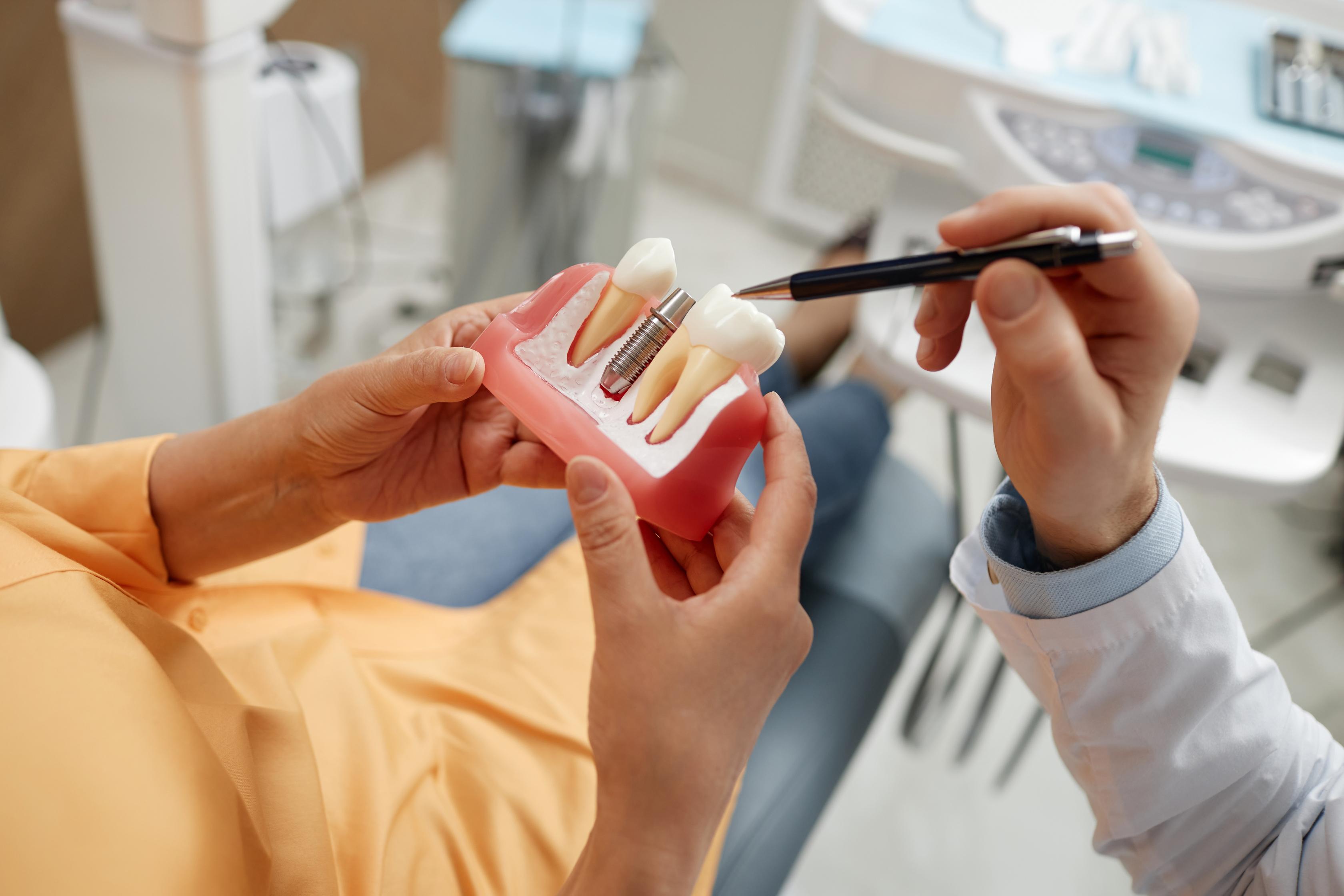 a dentist is holding a model of a dental implant in his hands .