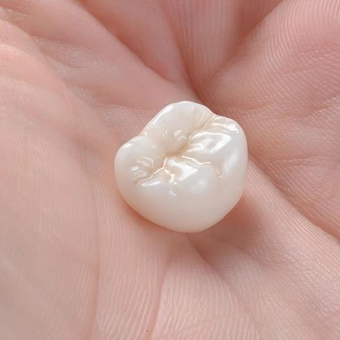 a person is holding a tooth in their hand .