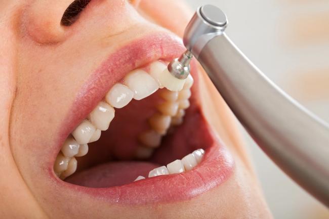 a woman is getting her teeth cleaned by a dentist .