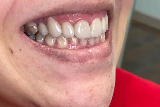 a close up of a person 's teeth with a red shirt on .