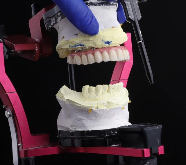 a dental technician is working on a model of a person 's teeth .