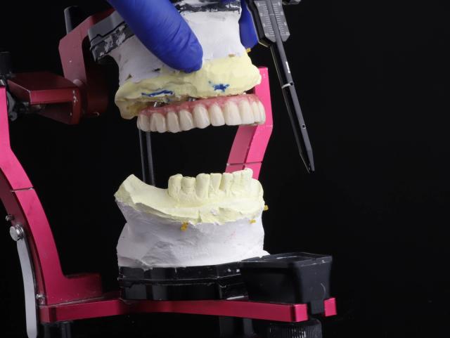 a dental technician is working on a model of a person 's teeth .