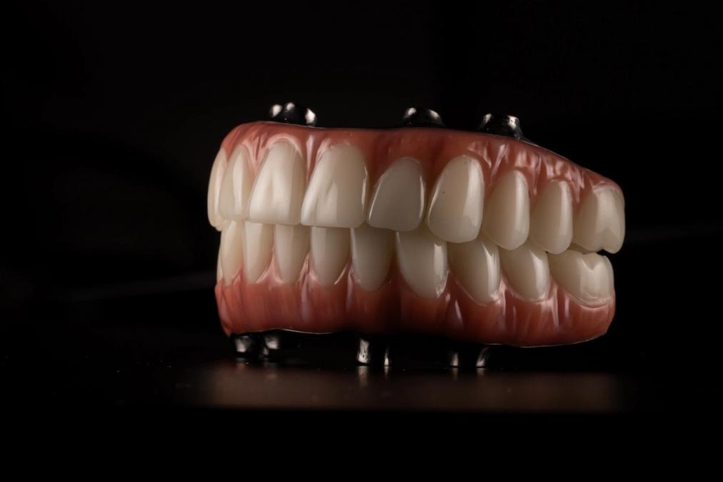 A full set of dental implants with pink gums and white teeth on a dark background.