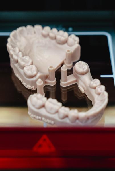 Light-colored 3D printed dental models of upper and lower jaws with teeth and posts on a dark surface.