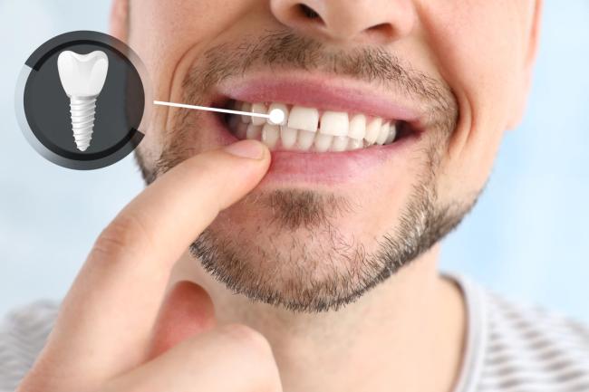 a man is pointing at a tooth in his mouth .