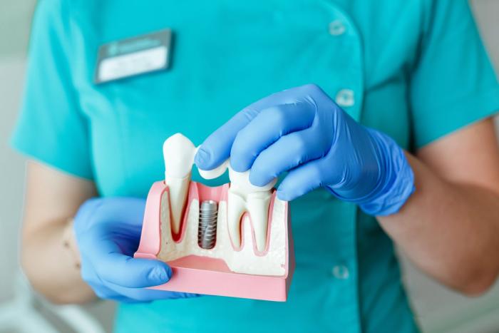 a dentist is holding a model of a dental implant in her hands .