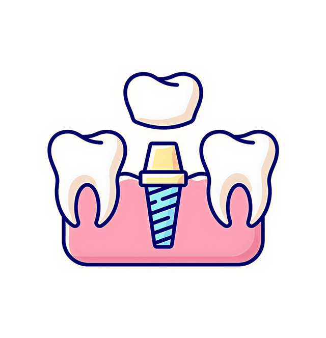 an illustration of a dental implant with a crown on top