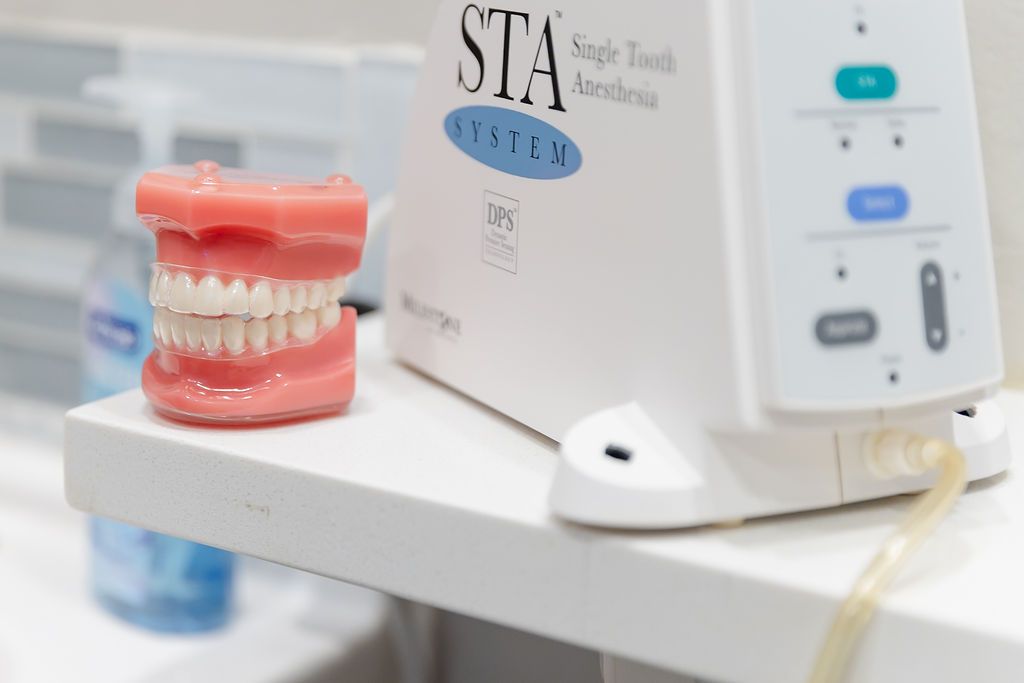 A dental model with a clear aligner sits next to a dental anesthesia machine.