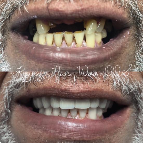 smile gallery photo 5