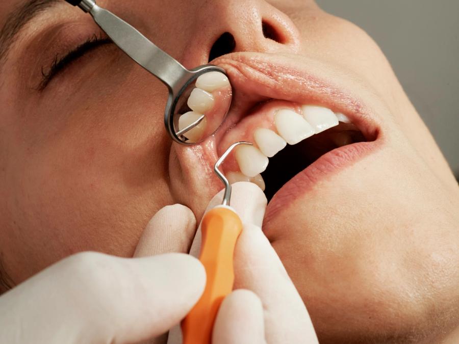a man is getting his teeth examined by a dentist .