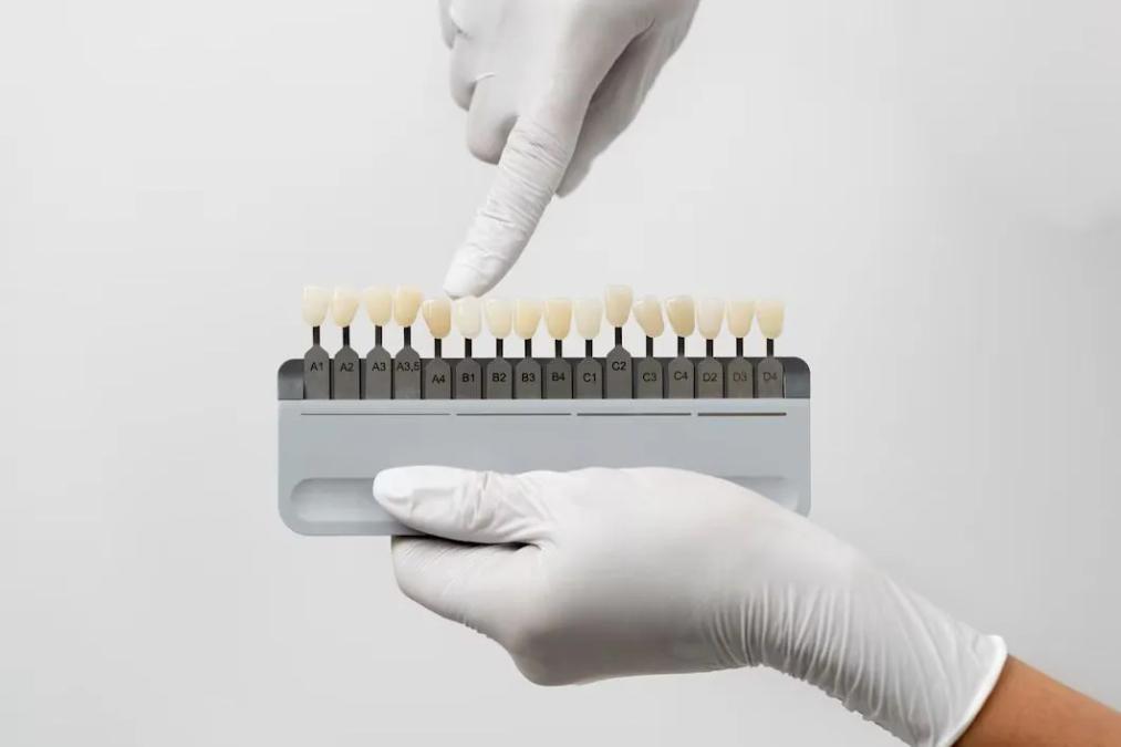 a dentist is holding a tooth color chart in his hand .