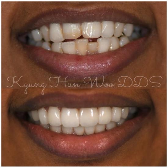 smile gallery photo 17