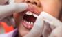 A gloved hand applies a solution to a child's front teeth with a cotton swab.