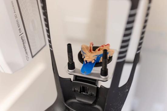 a dental impression is being made on a machine in a dental office .