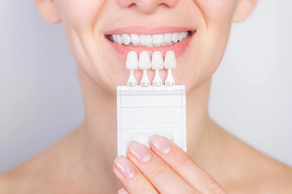 Smiling person holding a teeth whitening shade guide.