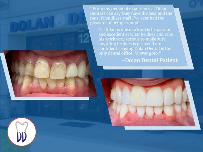 Before and after photos of a patient's teeth, showing a transformation from discolored and chipped to bright and even, alongside a positive testimonial for Dolan Dental.