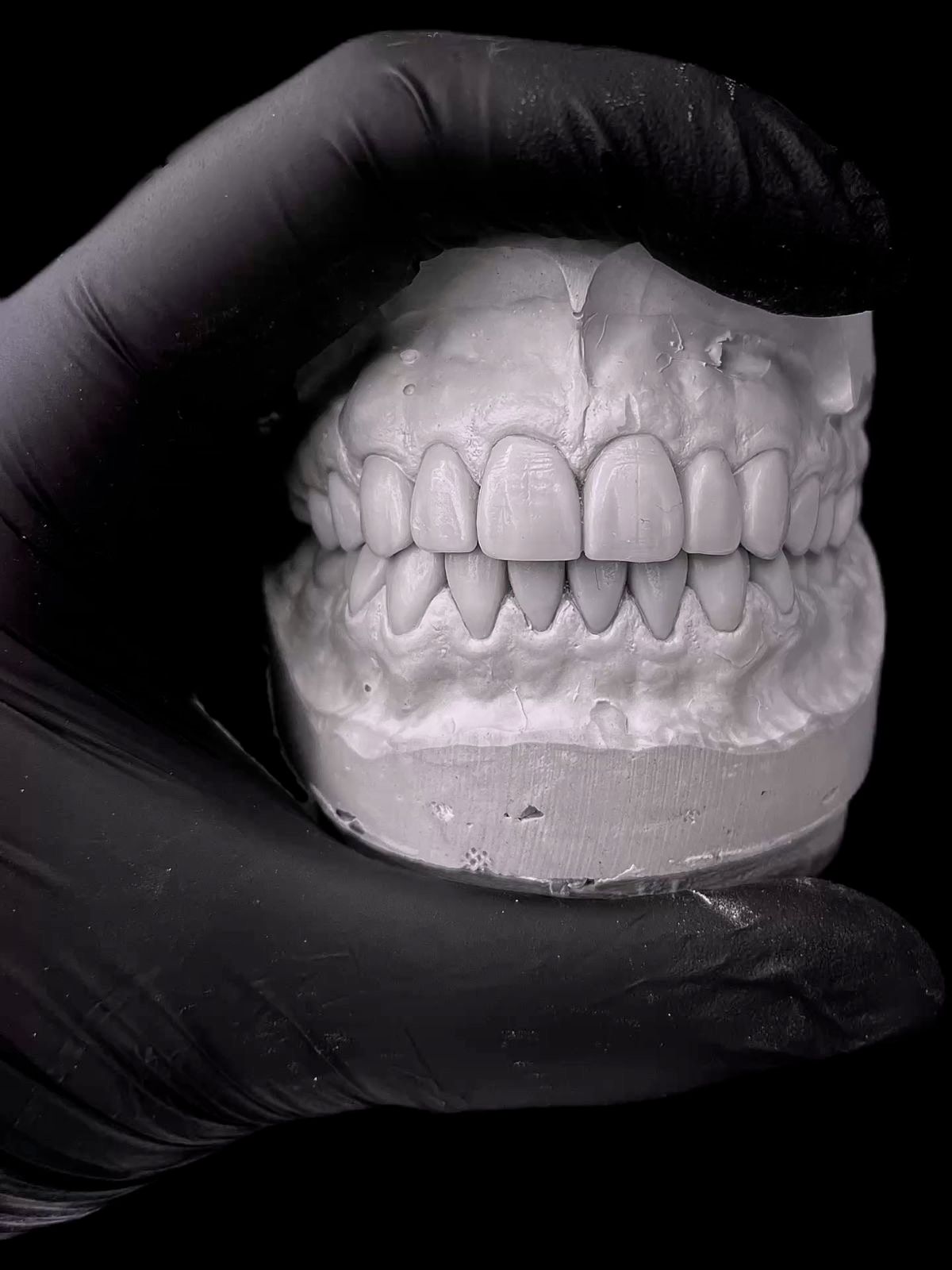 a person wearing a black glove is holding a model of a person 's teeth .