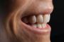 a close up of a person 's teeth with a black background .
