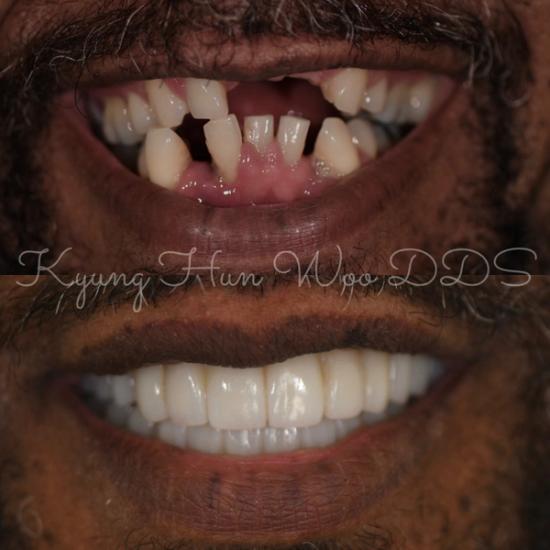 smile gallery photo 11