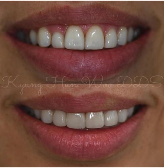 smile gallery photo 15