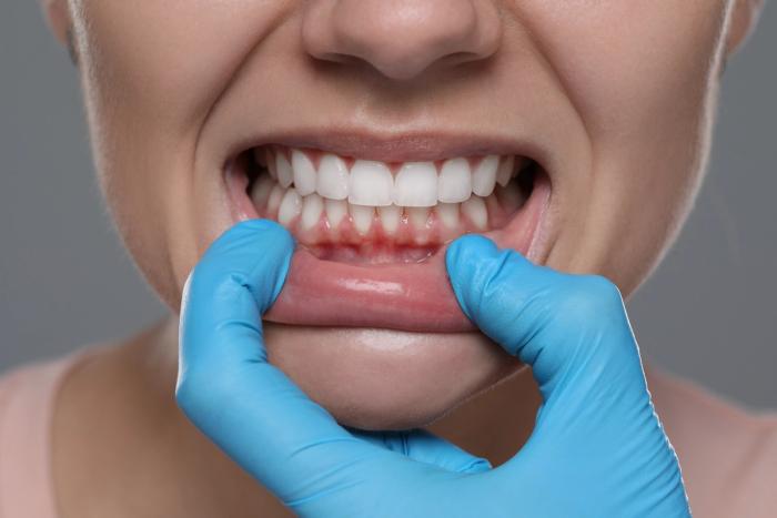 a woman is getting her teeth examined by a dentist .
